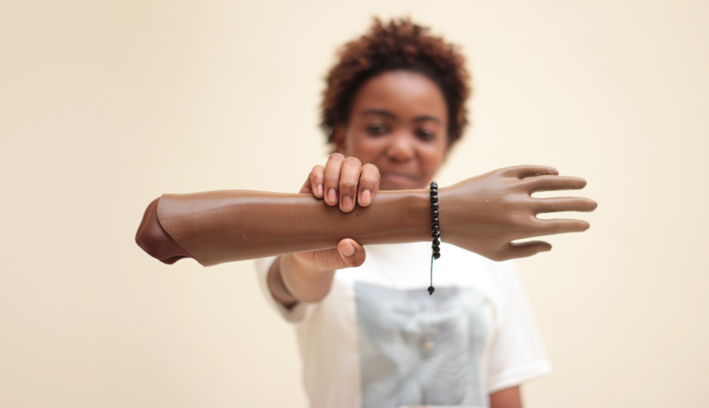 Ebe holding her Limb Forge 3D-printed arm.